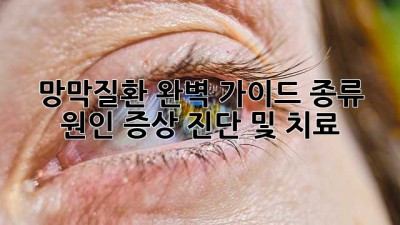 망막질환 완벽 가이드: 종류, 원인, 증상, 진단 및 치료